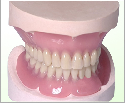 Full -mouth denture repair