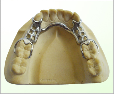 Pure titanium stent