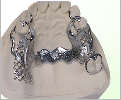 Cobalt chromium molybdenum support