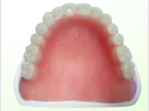 Repair for non -crushing gel dentures