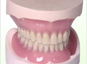 Full -mouth denture repair