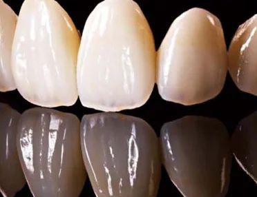 Revolutionary History of All Porcelain Teeth